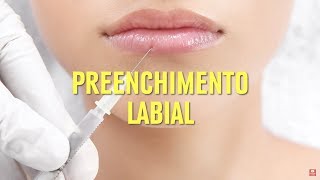 Tudo sobre PREENCHIMENTO LABIAL e como funciona o procedimento  Dr Erlacher [upl. by Armillia]