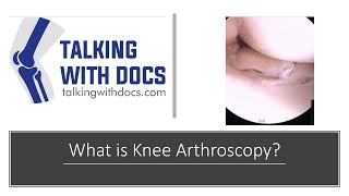 Watch Knee Arthroscopy Surgery  Knee Scope [upl. by Barry883]