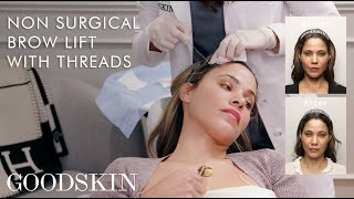 NonSurgical Brow Lift with Threads — Inside The Treatment Room  GOODSKIN [upl. by Mycah]