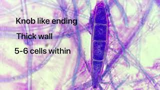 Microsporum canis cytology [upl. by Jump]