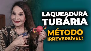 LAQUEADURA TUBÁRIA É um método IRREVERSÍVEL [upl. by Holle296]