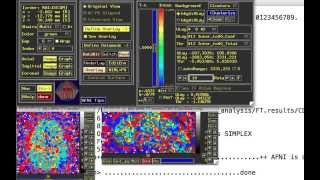 PsychoPhysiological Interactions or PPI aka ContextDependent Correlations [upl. by Annatnas767]