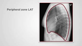 Radiological zones—and an introduction to landmarks [upl. by Kurman937]