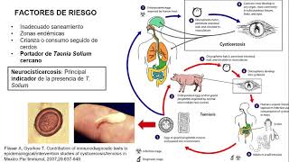 Cisticercosis y neurocisticercosis  SOCEMI [upl. by Dekow]