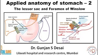 Lesser sac and foramen of Winslow  Applied anatomy of stomach part 2 [upl. by Mazur333]