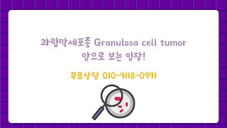 과립막세포종 Granulosa cell tumor 암으로 보는 입장 [upl. by Eural]