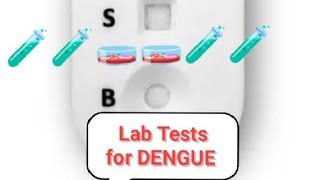 What are LAB TESTS in Dengue [upl. by Sheena]