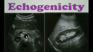 Echogenicity Ultrasound ultrasoundecgogenicity sonology [upl. by Anileba]