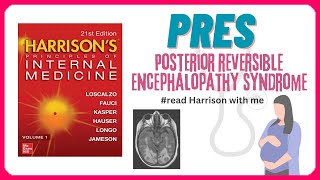 Posterior Reversible Encephalopathy Syndrome  PRES  Causes  Pathophysiology  Management [upl. by Cressida]