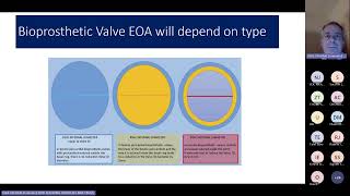 Prosthetic Heart Valve Assessment  Yorkshire regional valve teaching 17012024 [upl. by Judye]