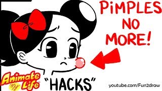 10 Ways to quotGet Rid Ofquot PIMPLES  Animate My Life HACKS [upl. by Arze]