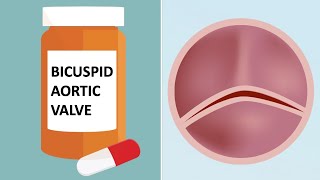 Bicuspid Aortic Valves amp Medication Top 7 Facts with Dr Luis Castro [upl. by Acisey]