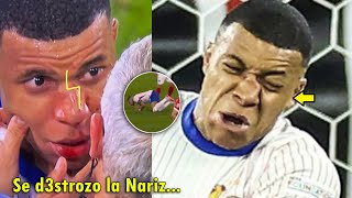 ASI FUE el TERRIBLE CHOQUE de MBAPPE SE ROMPIO  FRANCIA VS AUSTRIA 10 HOY [upl. by Lydon581]