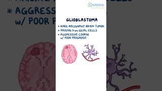 Glioblastoma [upl. by Dine]