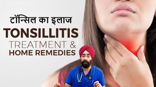 Tonsil ka Poora Ilaaj  Home Treatment and medicines for Tonsillitis  DrEducation [upl. by Eenert849]