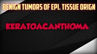 KERATOACANTHOMA  BENIGN EPI TUMOR [upl. by Sissy]