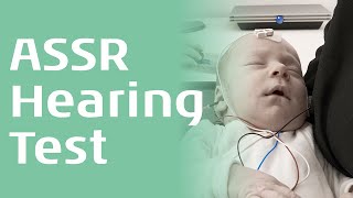 Auditory Steady State Response An Introduction [upl. by Nickles]