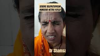 A Case of Blepharospasm Nimisha Netra Roga niajaipur dr Shamsa fiaz [upl. by Llednek797]