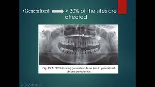 Chronic Periodontitis [upl. by Nylhsa162]