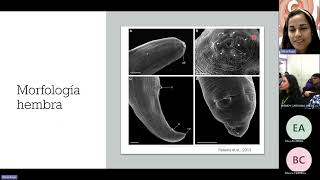 Clase Magistral Angiostrongiliasis A cantonensis y A costaricensis 20241104 110327 Grabación de l [upl. by Quarta]