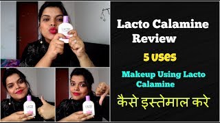 LACTO CALAMINE LOTION REVIEW IN HINDI FOR OILY amp DRY SKIN HOW TO APPLYUSE BENEFITS [upl. by Tsew]