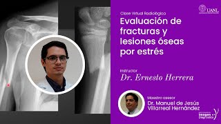 Evaluación de fracturas y lesiones óseas por estrés por el Dr Ernesto Herrera [upl. by Nahtal]