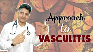 VASCULITIS  Classification  Approach  Management [upl. by Salem51]