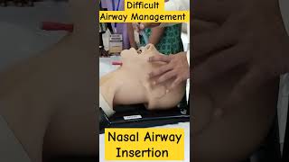 Nasopharyngeal Airway Insertion Technique nursingofficer hospital icunursing airwaymanagement [upl. by Peltz70]