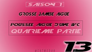 Ep13 Partie 4 la poussée aiguë dune IVC et le kyste poplité [upl. by Suhpesoj297]