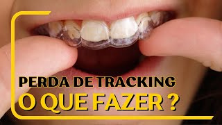 Perda de tracking com Alinhadores  Saiba o que fazer [upl. by Cheadle]