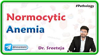 5 Normocytic Anemia  USMLE Step Pathology [upl. by Sumahs]