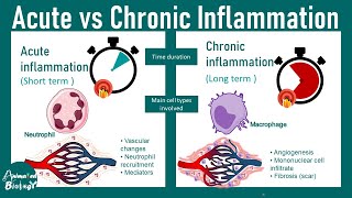 Acute vs Chronic inflammation  differences between acute and chronic inflammation  USMLE step 1 [upl. by Deb348]