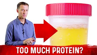 Top 5 Symptoms Of Eating Too Much Protein – DrBerg [upl. by Carlynne]