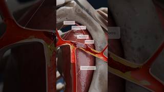 Thrombosis 3D animation  clot formation in the subclavian artery [upl. by Asiar]