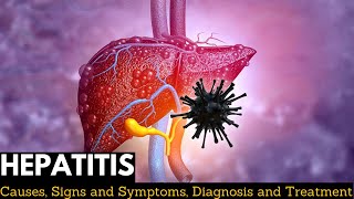 Hepatitis Causes Signs and Symptoms Diagnosis and Treatment [upl. by Hultin]