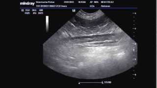 TROMBOSIS AORTA ABDOMINAL POR HIPER ADRENOCORTICISMO TAF [upl. by Aileve]