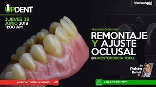 Remontaje y ajuste oclusal en prostodoncia total [upl. by Caressa]