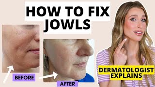 How to Fix Jowls Dermatologist Explains How to Prevent amp Get Rid of Jowls  Dr Sam Ellis [upl. by Anear]