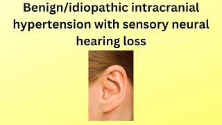 benign intracranial hypertension with hearing loss a rare case [upl. by Maag]