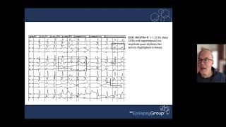 ICTAL INTERICTAL CONTINUUM 20211110 132939 Meeting Recording 1 [upl. by Hurst]