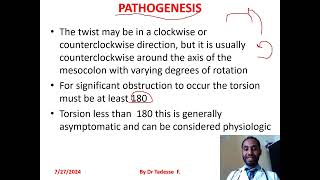 Volvulussigmoidcecaltransverse colonsplenic flexture part I by dr Tadesse fenta [upl. by Oren86]