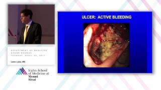 Management of Upper GI Bleeding [upl. by Joli515]