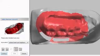 3Shape Tutorial  Scanning Anatomical Copings Changing Scan Settings and Achieving Accurate Scans [upl. by Calista824]