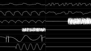 2xYM2612 Original quotAntithesisquot Oscilloscope View [upl. by Sokram]