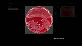 Lipohylic Test  Microbiology [upl. by Ocnarfnaig]