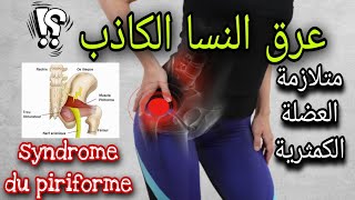 كل ما يمكن معرفته عن عرق النسا الكاذب أو متلازمة العضلة الكمثرية  le syndrome du piriforme [upl. by Nigem]