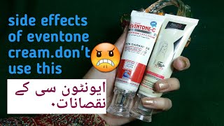 eventone c cream honest review  dont use it [upl. by France]