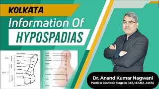 Complete Information about Hypospadias in Kolkata Hindi  वयस्क अधोमूत्रमार्गता  Dr Nagwani [upl. by Yllac]