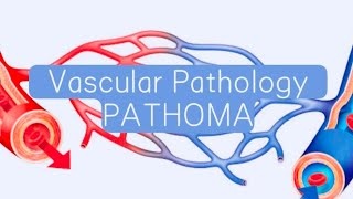 Vascular PATHOMA 5  ArteriolosclerosisMonkeburg sclerosis [upl. by Gnanmas]