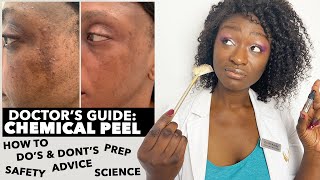 How To Get Rid Of Hyperpigmentation Melasma Acne Rough Texture BLACK DARK SKIN  Chemical Peels [upl. by Auhsohey]